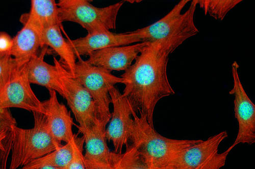 Vorläuferzellen der Maus mit Zellskelett (rot) und Zellkernen (blau).  Einige Tage Behandlung mit BMP reichen aus, um sie zu knochenbildenden Zellen umzuprogrammieren.
