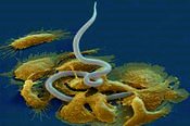 Diese Wurmart ist mit den Herz- und Hundehautwürmern verwandt. Sie zählen zu den Filarien, einer Überfamilie der Fadenwürmer.