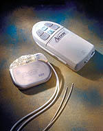 Hirnschrittmacher mit angeschlossenen Elektroden und Therapiesteuergerät