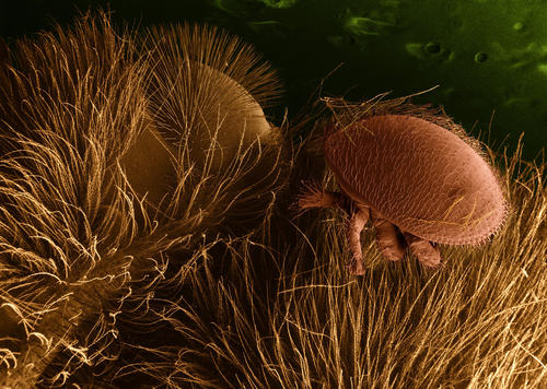 Huckepack: eine Milbe auf einer Biene unter dem Mikroskop