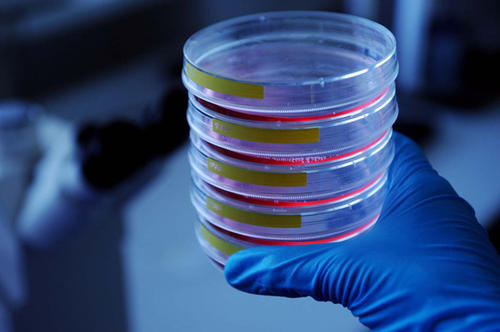 Einzel- und Verbundforschungsprojekte an der Freien Universität sollen durch Mittel des Innovationsfonds gefördert werden.