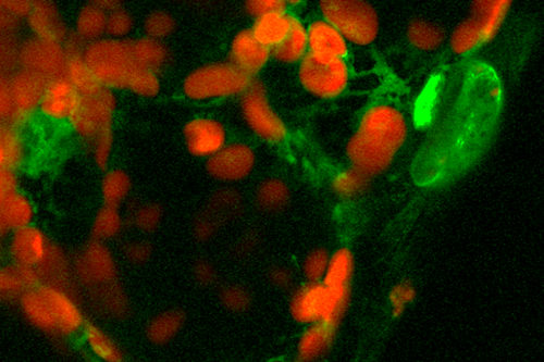 Mikroskopische Aufnahme von Keimblättern der Modellpflanze Arabidopsis mit Chloroplasten (rot) und dem SIG5-Protein (grün).