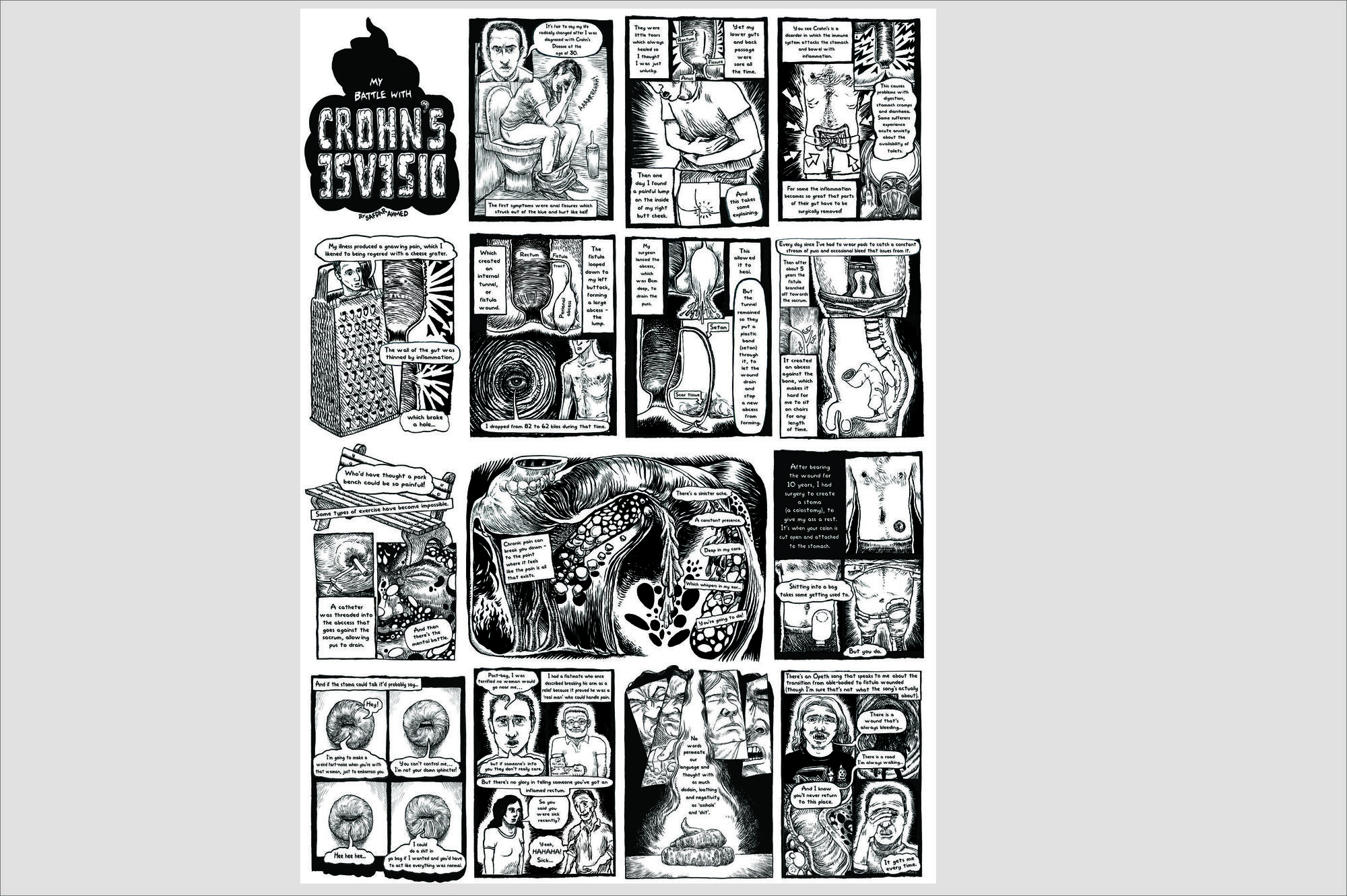 Krankheit im Comic: „Mein Ringen mit Morbus Crohn“ von Safdar Ahmed wird im Rahmen der Ausstellung im Medizinhistorischen Museum präsentiert.