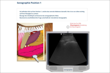 ... and animations, photos, and interactive elements such as virtual ultrasound.