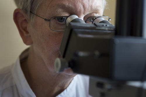 Für die Prävention von Gebärmutterhalskrebs muss die Ärztin häufig am Mikroskop arbeiten.