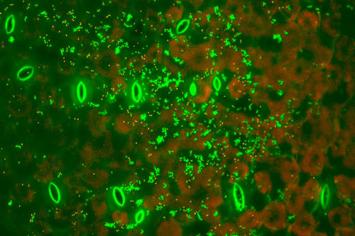Ein Blatt mit angefärbten Bakterien unter dem Mikroskop: Lebendig leuchten sie grün – rot steht für tot.