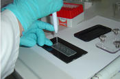 Molecular biological study is done on Campylobacter. They are among the zoonotic pathogens that can be transmitted through food and cause inflammatory diarrhea in humans.