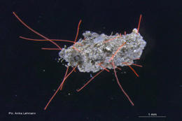 microplastic-7