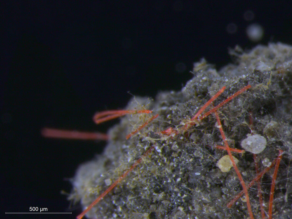 Red polypropylene (polypropylene) microplastic fibers in a soil aggregate.
