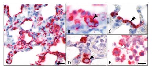 View of infected lung tissue (image A)