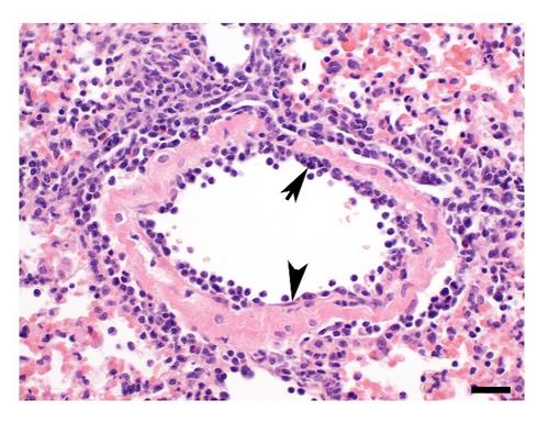 Endothelium (arrowhead icon)
