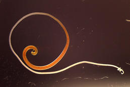 New studies offer hope that the whipworm could be used in developing a new asthma medication.