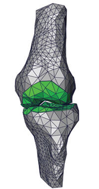 Das Knie im Dreiecksnetz <br/> Abb.: AG Kornhuber