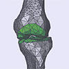 Das Knie im Dreiecksnetz 