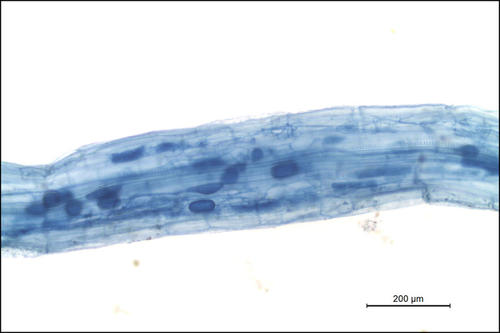 Die Tyran-Blaufärbung macht die feinen Strukturen des Mykorrhizapilzes in der Wurzelrinde der Pflanzen sichtbar. Der Pilz unterstützt seine Wirtspflanze bei der Nährstoff- und Wasserversorgung.