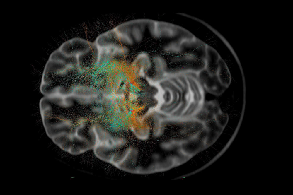 Blick ins menschliche Gehirn: Neurologische und psychiatrische Erkrankungen können viele Ursachen haben.