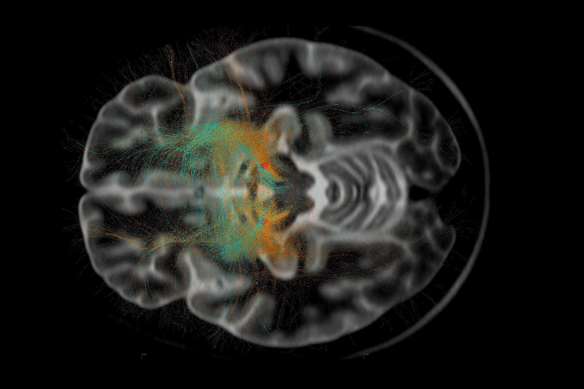 Blick ins menschliche Gehirn: Neurologische und psychiatrische Erkrankungen können viele Ursachen haben.