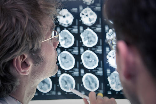 Das Zentrale Nervensystem im Blick: Bildgebende Verfahren sind eine wichtige Grundlage für die Diagnose neurologischer und psychiatrischer Erkrankungen.